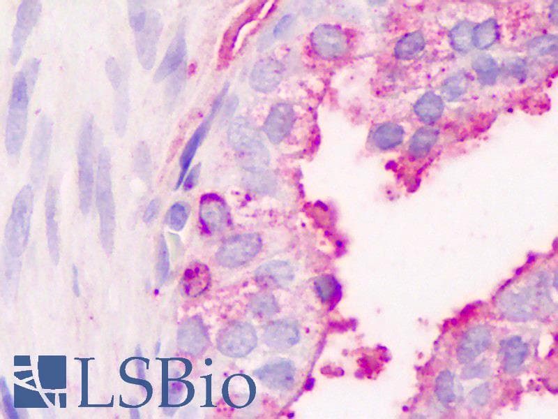 DUX4 Antibody (C-Terminus, clone P2B1, APC)