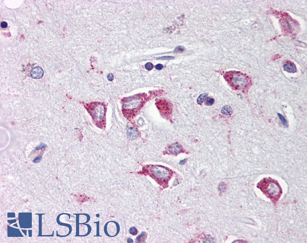 IHC-plus™ PCBP4 Antibody