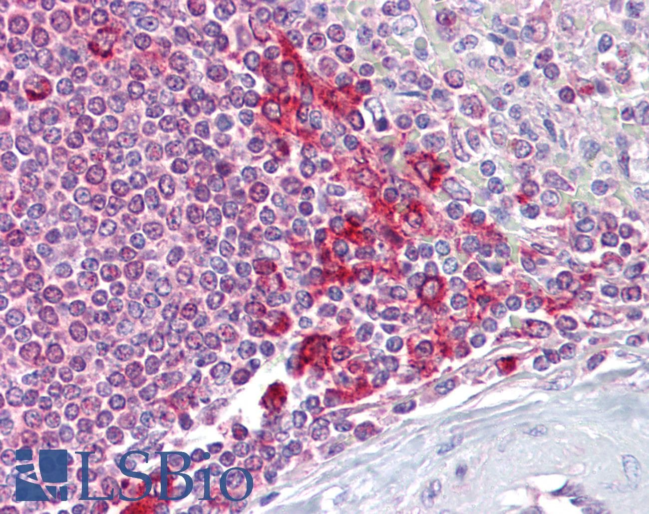 IHC-plus™ Requiem / DPF2 Antibody