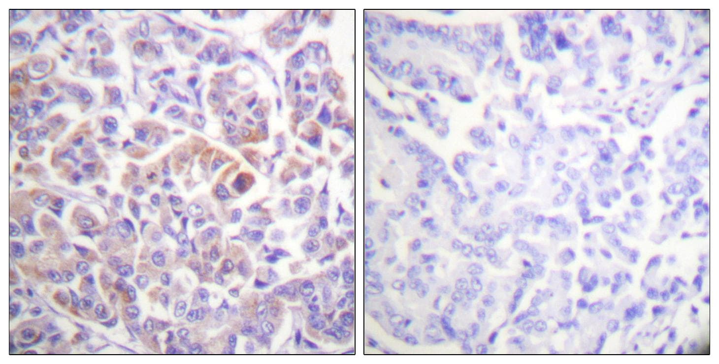 RAF1 / RAF Antibody (p296)
