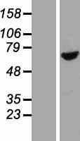 BBS1 Protein (Over-Expression Lysate Myc-DDK (Flag))