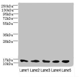 TIMM10B / FXC1 Antibody