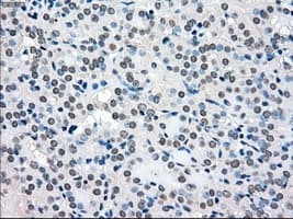 BRAF / B-Raf Antibody (clone OTI4A5)