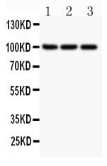 NFKB2 Antibody (aa1-340)