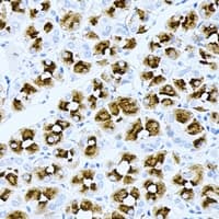 ASMTL Antibody