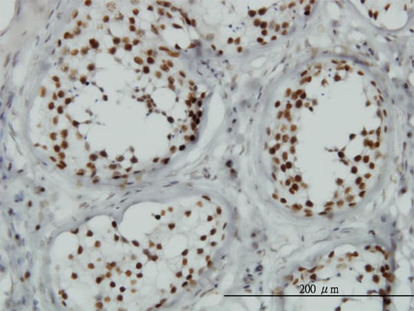 TLK1 Antibody (clone 4B3)
