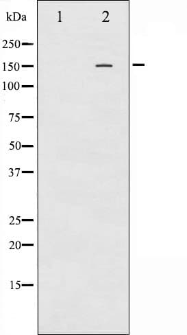PDGFRB / PDGFR Beta Antibody (phospho-Tyr740)