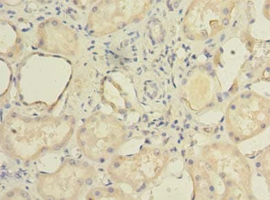 TCTE1 Antibody