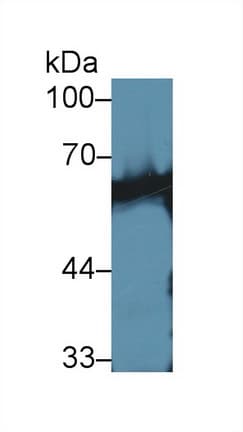 Calcineurin Antibody (aa7-301)