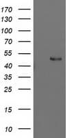 Monoclonal Mouse anti-Human PBX1 Antibody (clone OTI1C11, IHC, IF, WB)