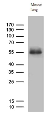 Monoclonal Mouse anti-Human MOK / RAGE Antibody (clone OTI9G8, aa205-419, WB)