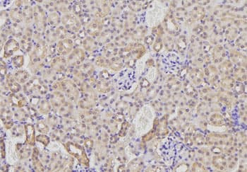Polyclonal Rabbit anti-Human GP78 / AMFR Antibody (IHC, WB)