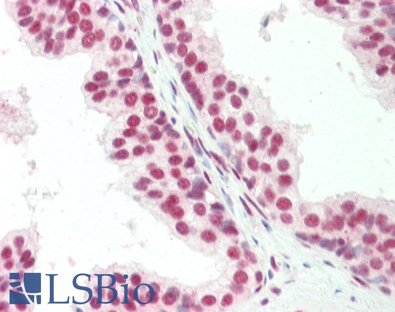 CTBP1 / CTBP Antibody (C-Terminus)