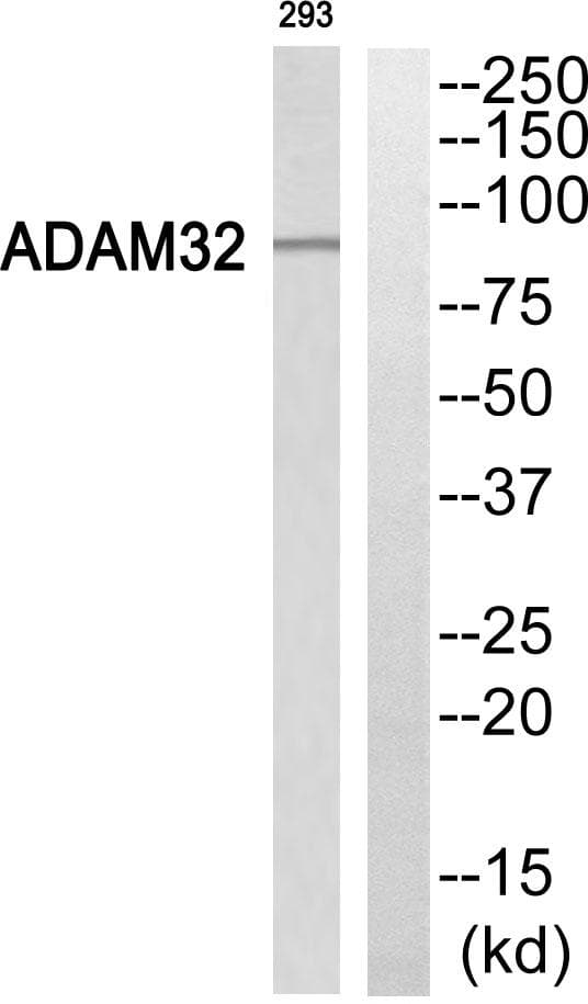 Polyclonal Rabbit anti-Human ADAM32 Antibody (WB)