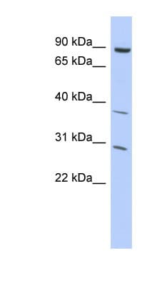 KLHL5 Antibody (C-Terminus)