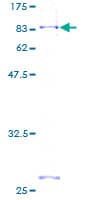 Human FGFRL1 Protein (Recombinant GST)
