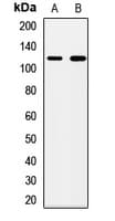 PMPCA Antibody