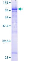 Human CDK5RAP3 Protein (Recombinant GST)