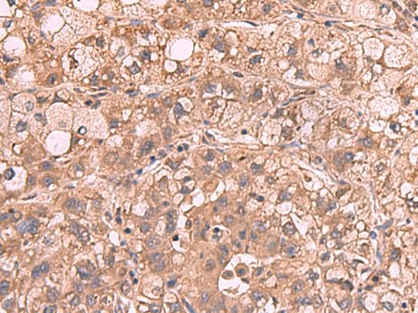 PPP2R1A Antibody