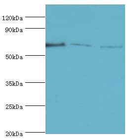 Polyclonal Rabbit anti-Human TDP1 Antibody (aa1-260, IHC, WB)