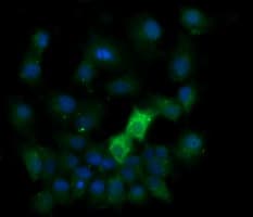 KLK8 / Kallikrein 8 Antibody (clone OTI10F9)
