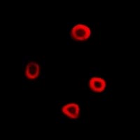 Polyclonal Rabbit anti-Human BAIAP2 / IRSP53 Antibody (IHC, IF, WB)