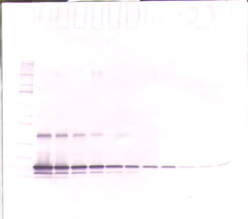IHC-plus™ Polyclonal Rabbit anti-Human TIMP1 Antibody (aa24-207, IHC, WB)