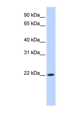 DPCD Antibody (aa72-121)