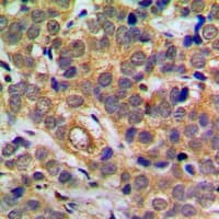 RELA / NFKB p65 Antibody (phospho-Ser311)