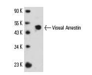 SAG / Arrestin Antibody (clone PDS-1, Biotin)