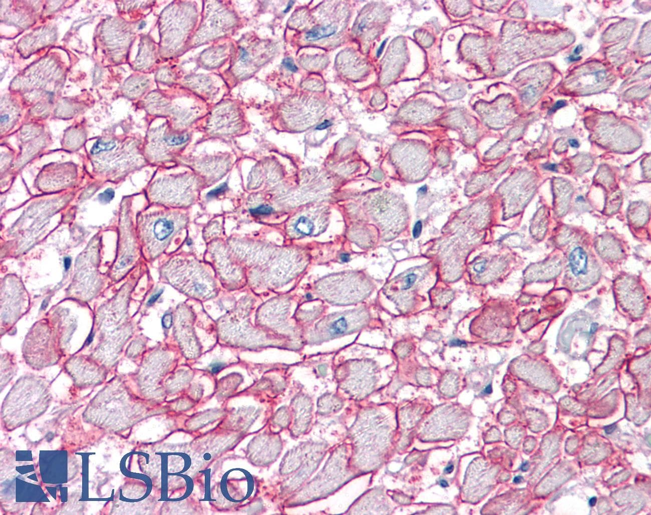 IHC-plus™ Monoclonal Mouse anti-Human SGCB / SGC / Sarcoglycan Beta Antibody (clone 1C10, IHC, IF, WB)