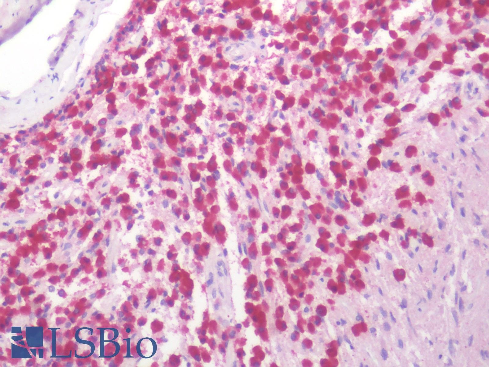 PathPlus™ Polyclonal Rabbit anti-Human OXTR / Oxytocin Receptor Antibody (N-Terminus, IHC)