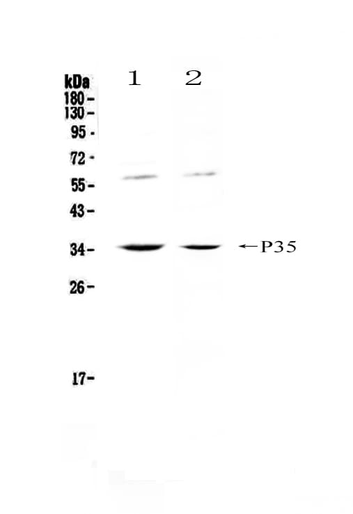 Polyclonal Rabbit anti-Rat IL12A / p35 Antibody (IHC, WB)