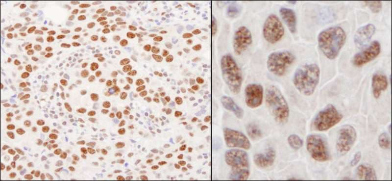 HnRNP U Antibody (aa450-500)