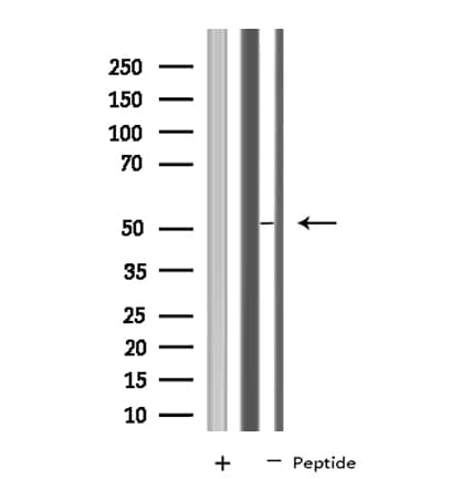 IOP1 / NARFL Antibody