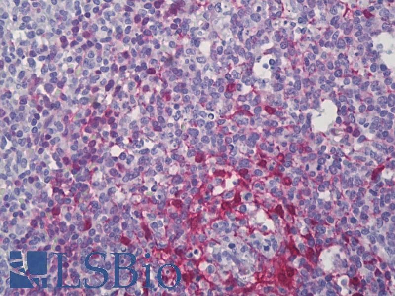 IHC-plus™ Polyclonal Rabbit anti-Human PDLIM1 Antibody (aa61-110, IHC, IF, WB)