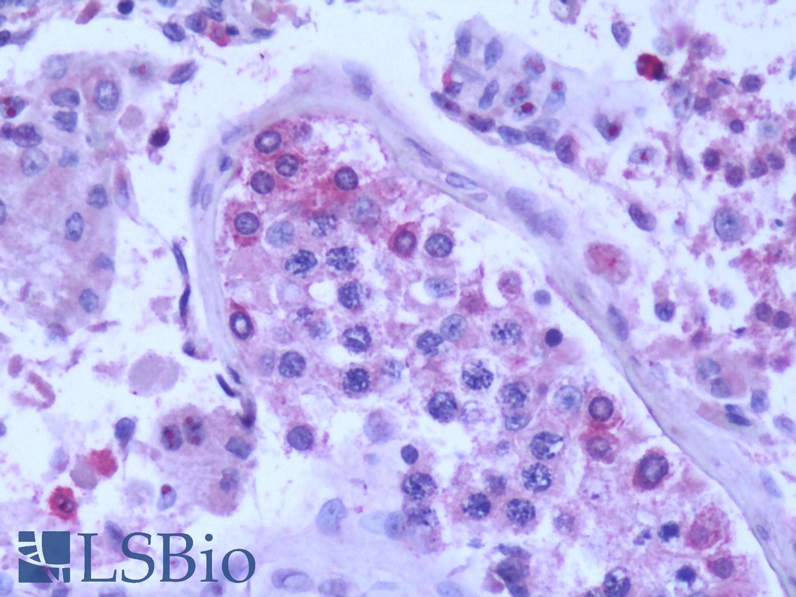 IHC-plus™ SPAG16 Antibody (aa157-168)