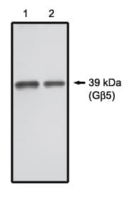 IHC-plus™ Polyclonal Rabbit anti-Human GB5 / GNB5 Antibody (IHC, WB)