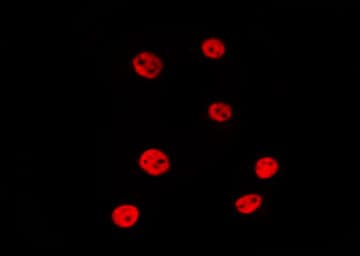 USP16 Antibody
