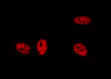 BRD3 Antibody