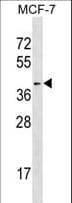 HDAC11 Antibody (aa1-30)