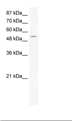 CPA1 / Carboxypeptidase A Antibody (aa24-73)
