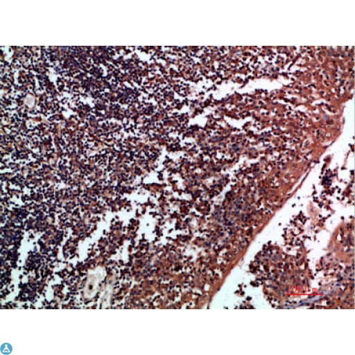 TNR / Tenascin R Antibody
