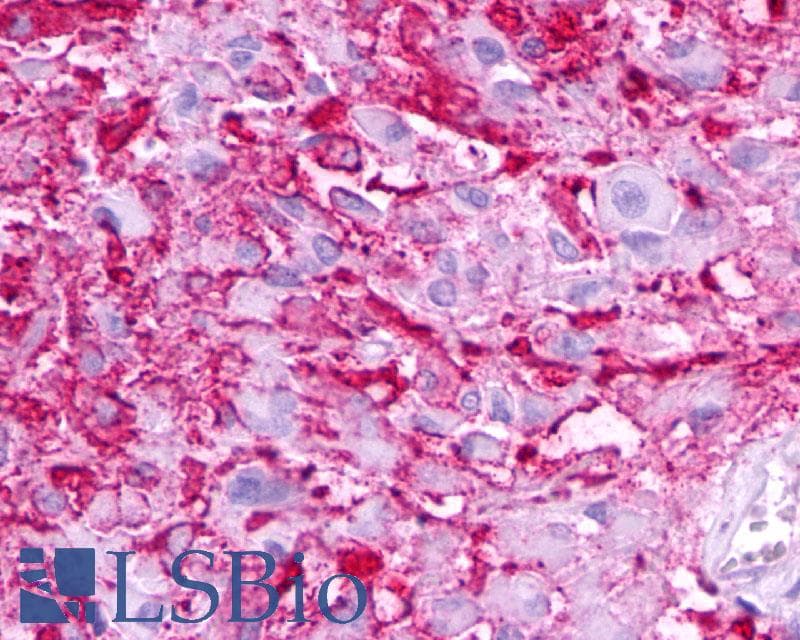 IHC-plus™ Polyclonal Rabbit anti-Human MC5R / MC5 Receptor Antibody (N-Terminus, IHC)