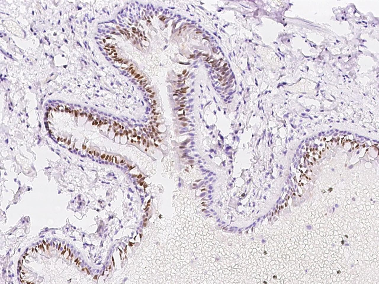 Polyclonal Rabbit anti-Human PAPSS 1 Antibody (IHC, IF, WB)