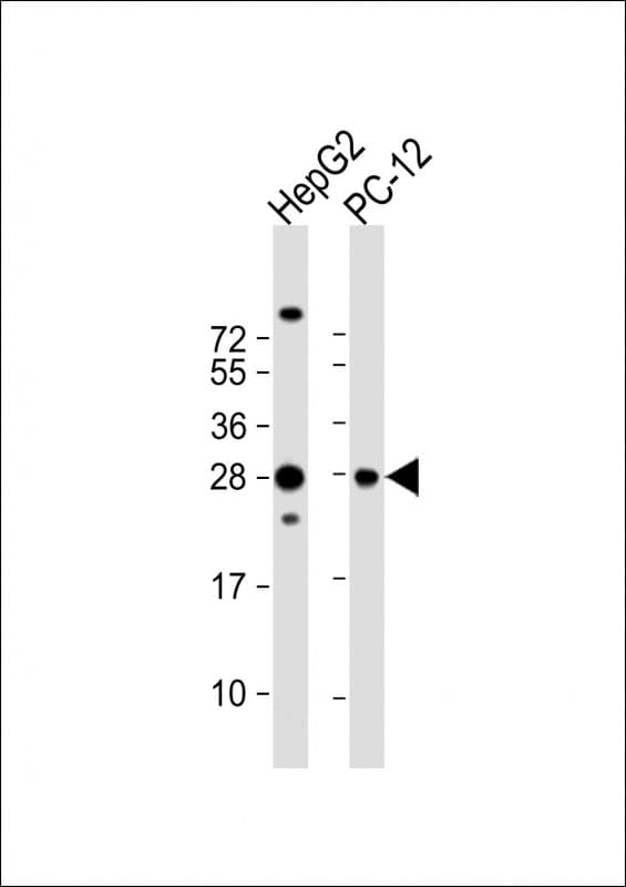 PCMT1 Antibody (N-Terminus)
