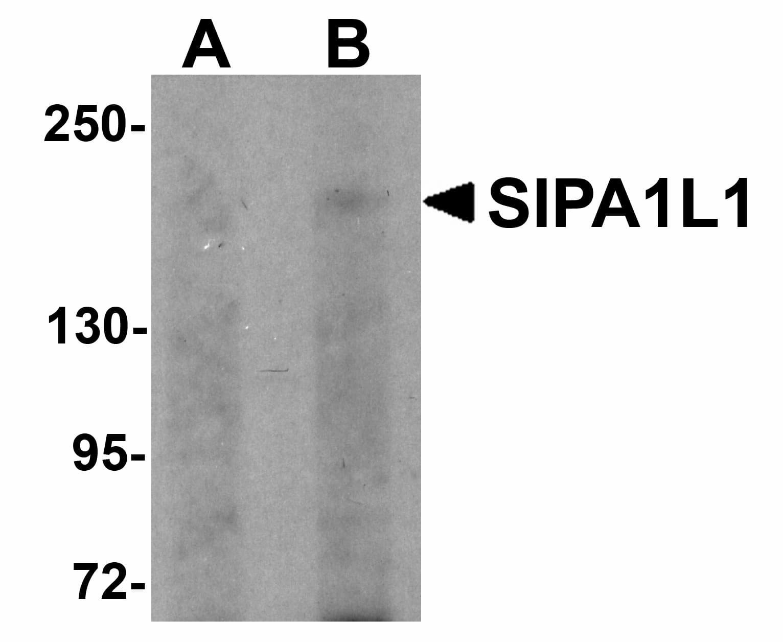 IHC-plus™ E6TP1 / SIPA1L1 Antibody