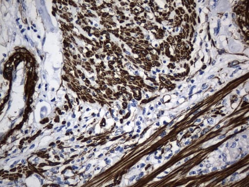 ACTA2 / Smooth Muscle Actin Antibody (N-Terminus, clone UMAB237)
