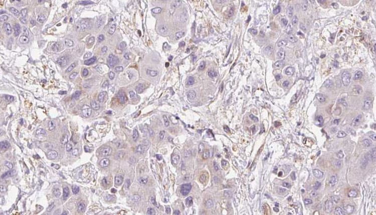 Polyclonal Rabbit anti-Human NMUR2 Antibody (IHC, WB)