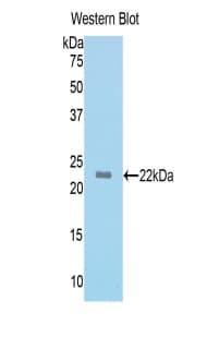 MYL4 Antibody (aa6-191)